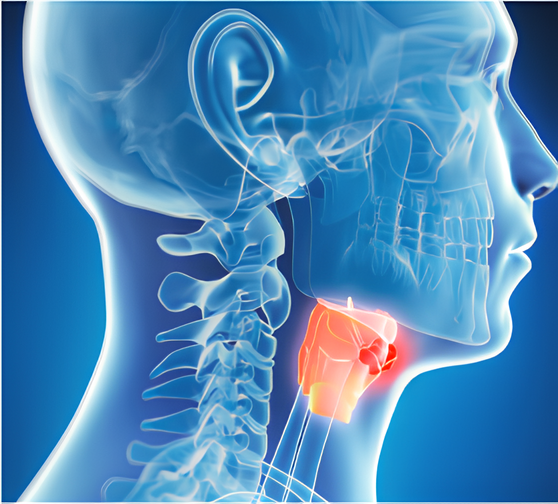 Speech Therapy after Laryngectomy:  Vocal and Swallow Rehabilitation